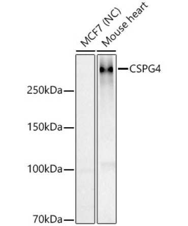 NG2/CSPG4 Rabbit Polyclonal Antibody [KO Validated]