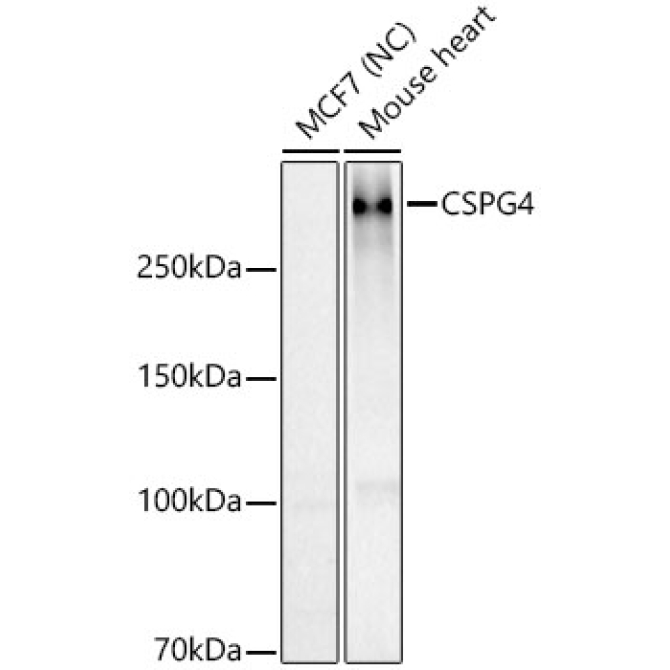 NG2/CSPG4 Rabbit Polyclonal Antibody [KO Validated]