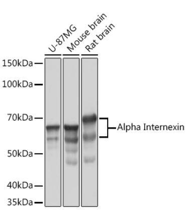 Alpha Internexin Rabbit Monoclonal Antibody