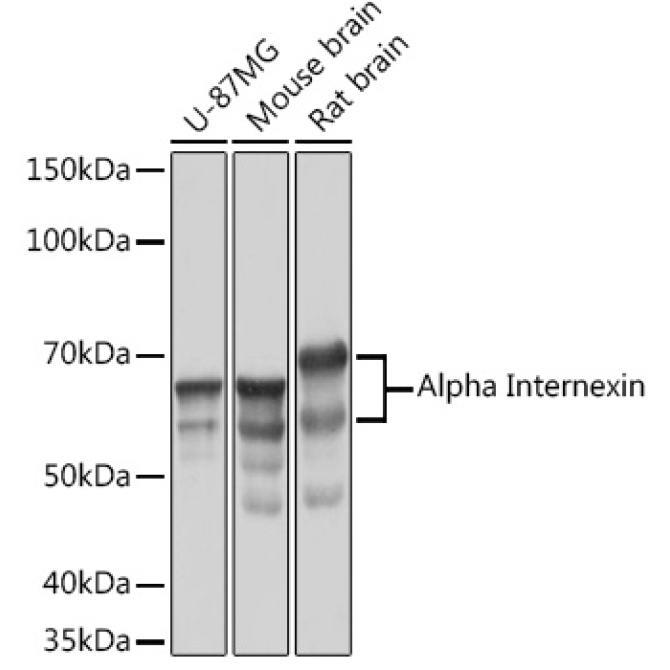 Alpha Internexin Rabbit Monoclonal Antibody
