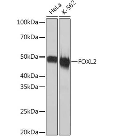 FOXL2 Rabbit Monoclonal Antibody