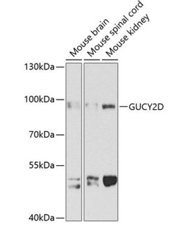 GUCY2D Rabbit Polyclonal Antibody