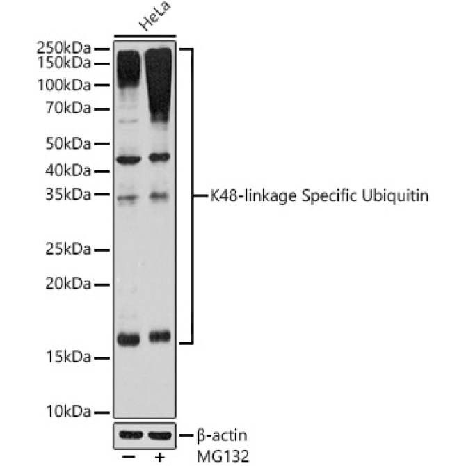 K48-linkage Specific Ubiquitin Rabbit Monoclonal Antibody