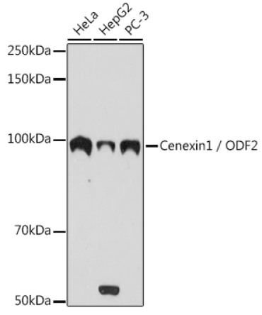 Cenexin1 / ODF2 Rabbit Monoclonal Antibody