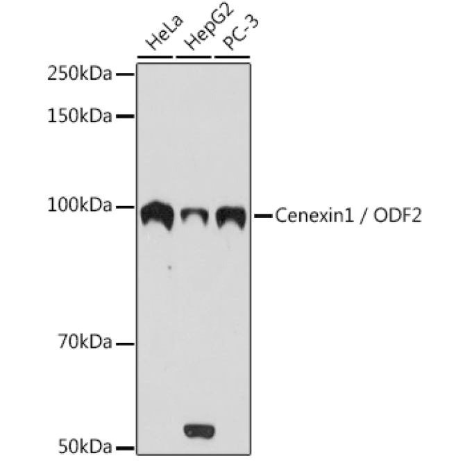 Cenexin1 / ODF2 Rabbit Monoclonal Antibody
