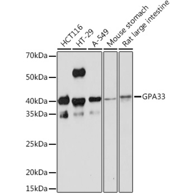 GPA33 Rabbit Monoclonal Antibody