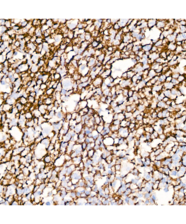 CD35/CR1 Rabbit Monoclonal Antibody