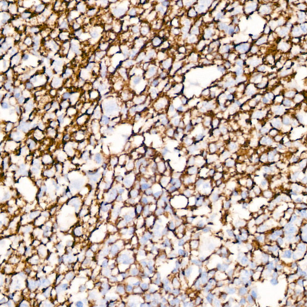 CD35/CR1 Rabbit Monoclonal Antibody