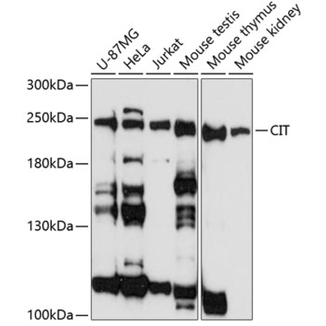 CIT Rabbit Polyclonal Antibody