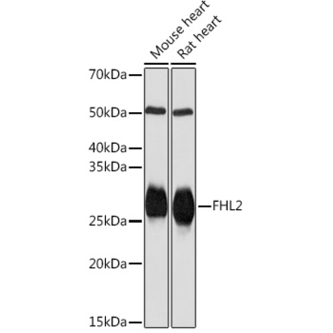 FHL2 Rabbit Monoclonal Antibody