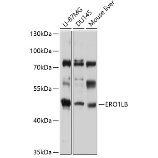 ERO1LB Rabbit Polyclonal Antibody