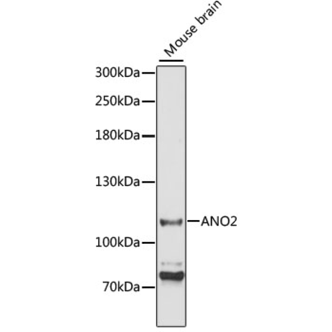 ANO2 Rabbit Polyclonal Antibody