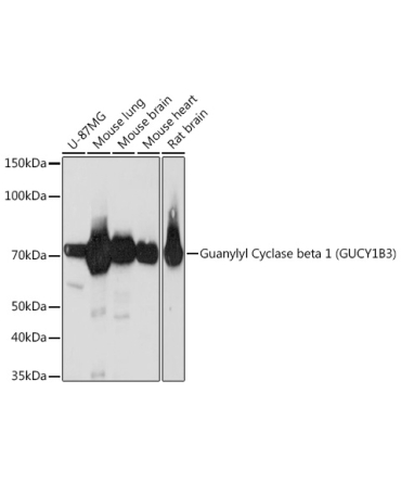 Guanylyl Cyclase beta 1 (GUCY1B3) Rabbit Monoclonal Antibody