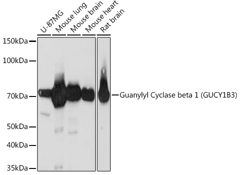 Guanylyl Cyclase beta 1 (GUCY1B3) Rabbit Monoclonal Antibody