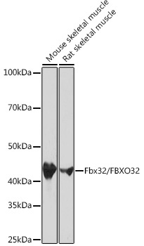 Fbx32/FBXO32 Rabbit Monoclonal Antibody