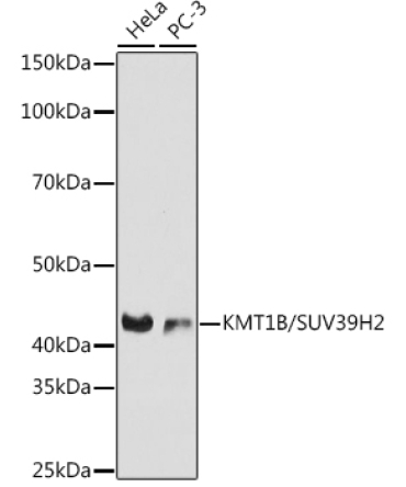 KMT1B / SUV39H2 Rabbit Monoclonal Antibody