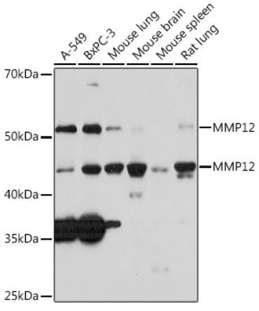 MMP12 Rabbit Monoclonal Antibody