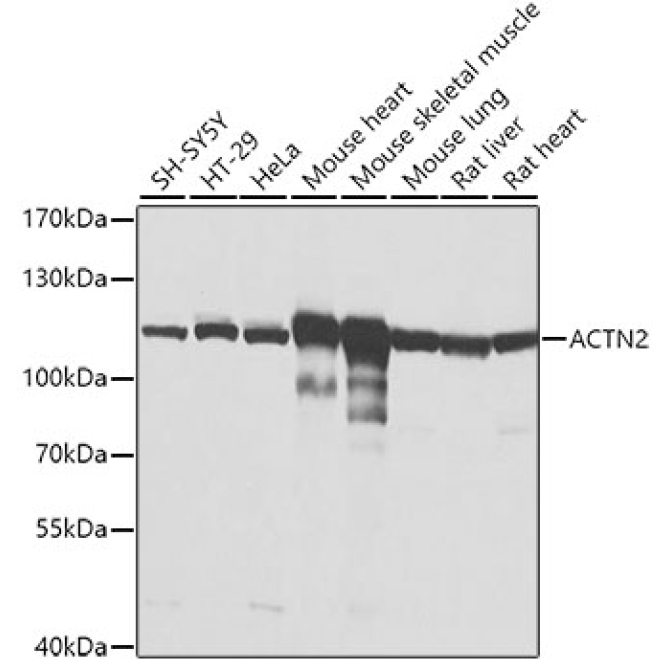ACTN2 Rabbit Polyclonal Antibody