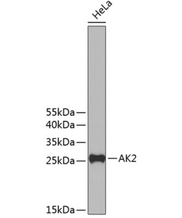 AK2 Rabbit Polyclonal Antibody