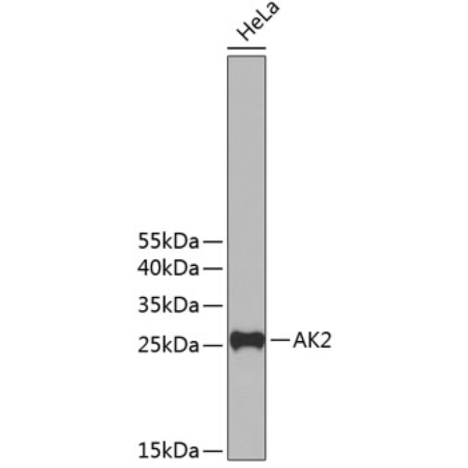 AK2 Rabbit Polyclonal Antibody