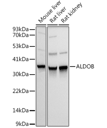 ALDOB Rabbit Polyclonal Antibody