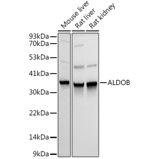 ALDOB Rabbit Polyclonal Antibody