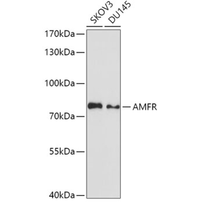 AMFR Rabbit Polyclonal Antibody