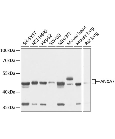 ANXA7 Rabbit Polyclonal Antibody