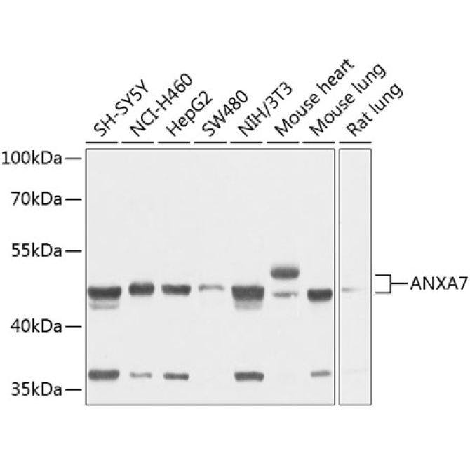 ANXA7 Rabbit Polyclonal Antibody