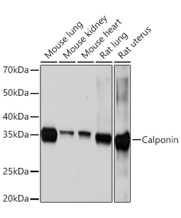 Calponin Rabbit Monoclonal Antibody