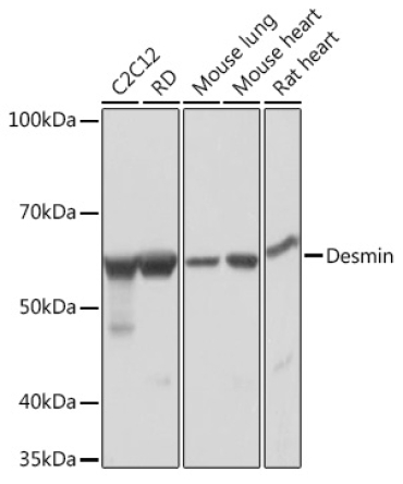 Desmin Rabbit Monoclonal Antibody