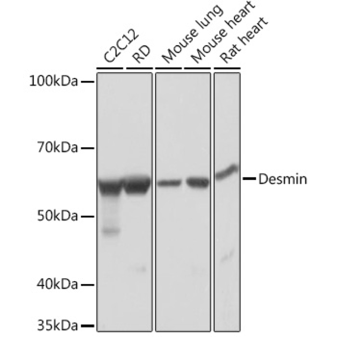 Desmin Rabbit Monoclonal Antibody