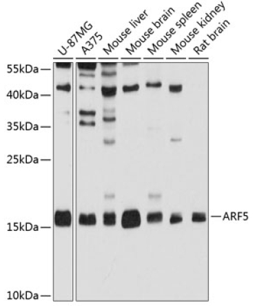 ARF5 Rabbit Polyclonal Antibody