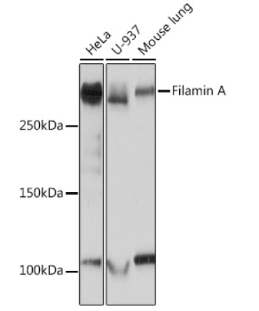 Filamin A Rabbit Monoclonal Antibody