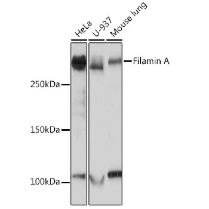 Filamin A Rabbit Monoclonal Antibody