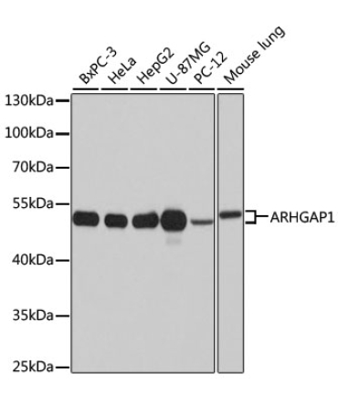 ARHGAP1 Rabbit Polyclonal Antibody