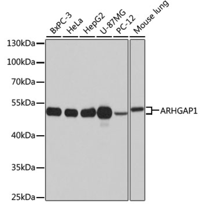 ARHGAP1 Rabbit Polyclonal Antibody