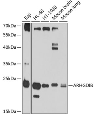 ARHGDIB Rabbit Polyclonal Antibody