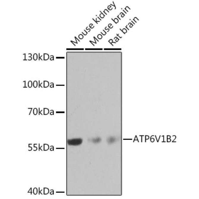 ATP6V1B2 Rabbit Polyclonal Antibody