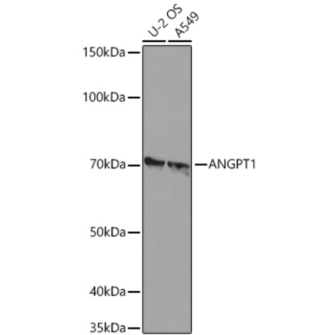ANGPT1 Rabbit Monoclonal Antibody