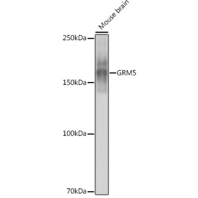 GRM5 Rabbit Monoclonal Antibody