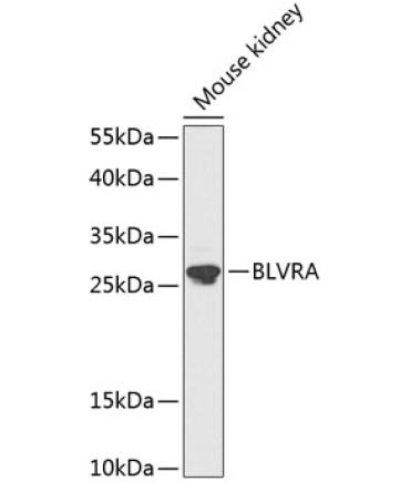 BLVRA Rabbit Polyclonal Antibody