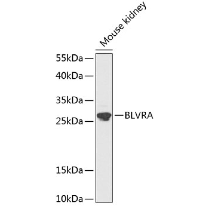 BLVRA Rabbit Polyclonal Antibody