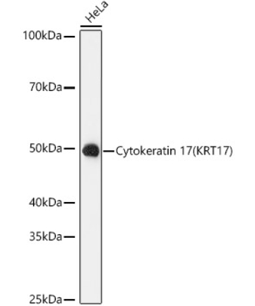 Cytokeratin 17 (KRT17) Rabbit Monoclonal Antibody