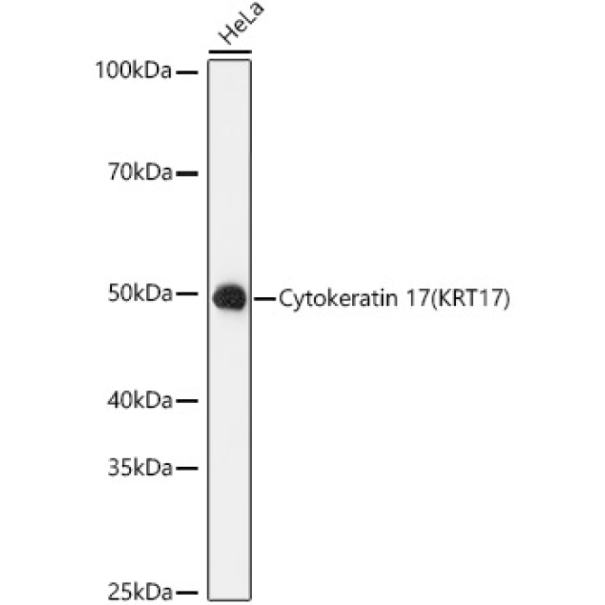 Cytokeratin 17 (KRT17) Rabbit Monoclonal Antibody
