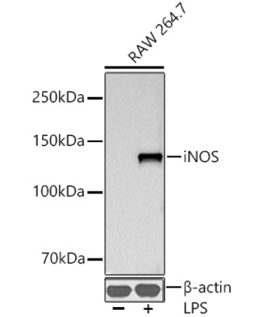 iNOS Rabbit Monoclonal Antibody