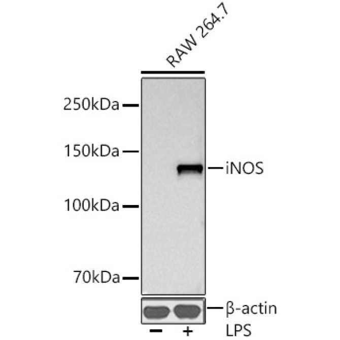 iNOS Rabbit Monoclonal Antibody