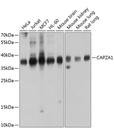 CAPZA1 Rabbit Polyclonal Antibody
