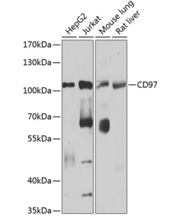 CD97 Rabbit Polyclonal Antibody