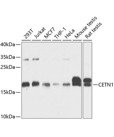 CETN1 Rabbit Polyclonal Antibody